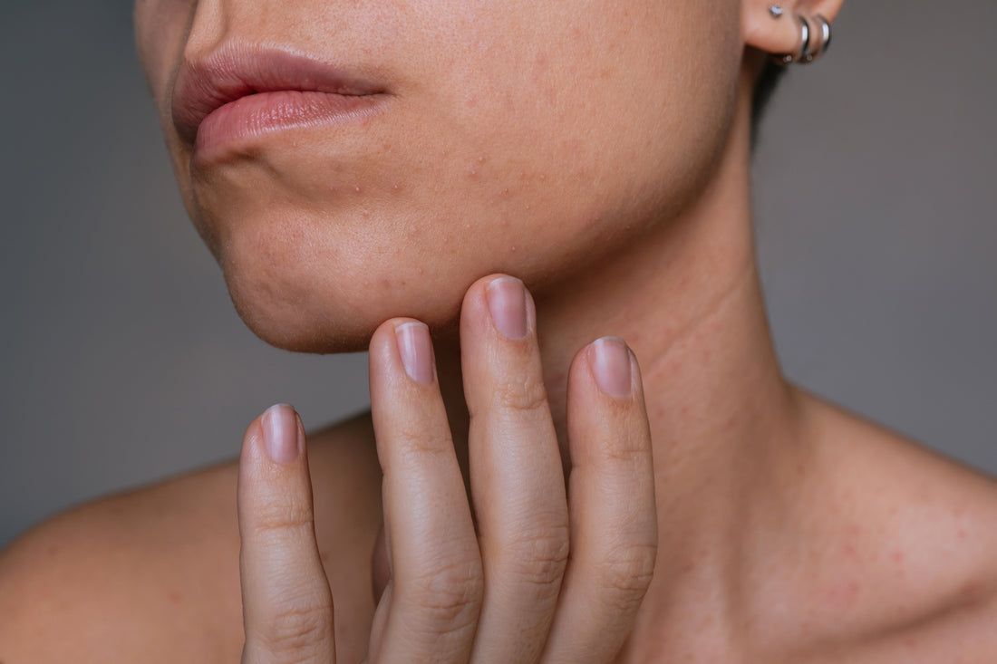 Comprehensive Guide: How to Know If You Have Sensitive Skin